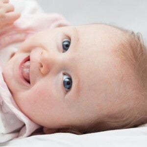 Baby lying down on bed with cradle cap on head