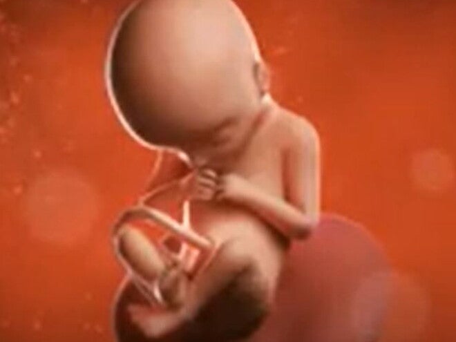 20 Weeks Pregnant video