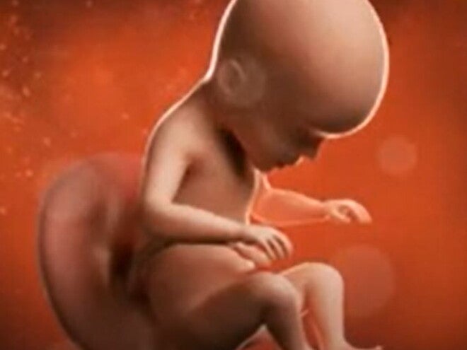 24 Weeks Pregnant video